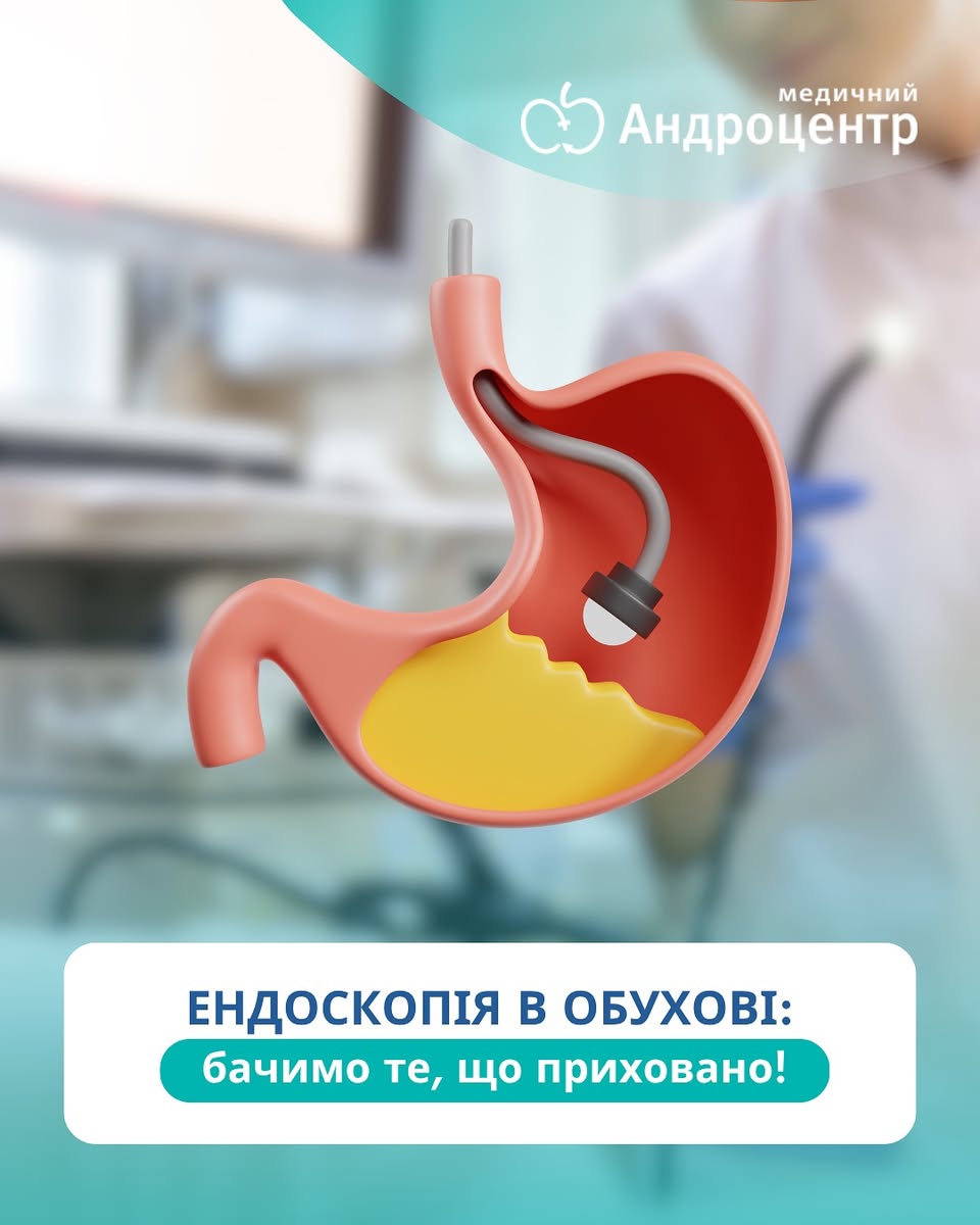 Ендоскопічна діагностика в Обухові: сучасний підхід до здоров’я